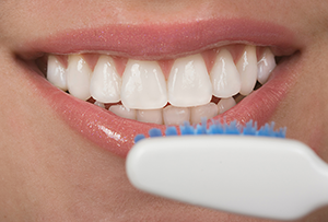 Veneers | Dentist in Yonkers, NY | General, Cosmetic and Implant Dentistry