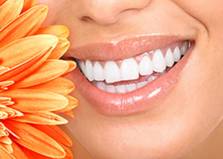 teeth whitening Yonkers, NY | General, Cosmetic and Implant Dentistry